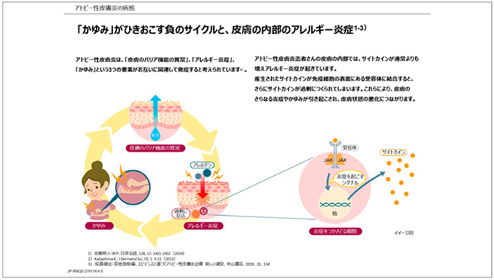 Figure.5 Pathogenesis of Atopic Dermatitis<